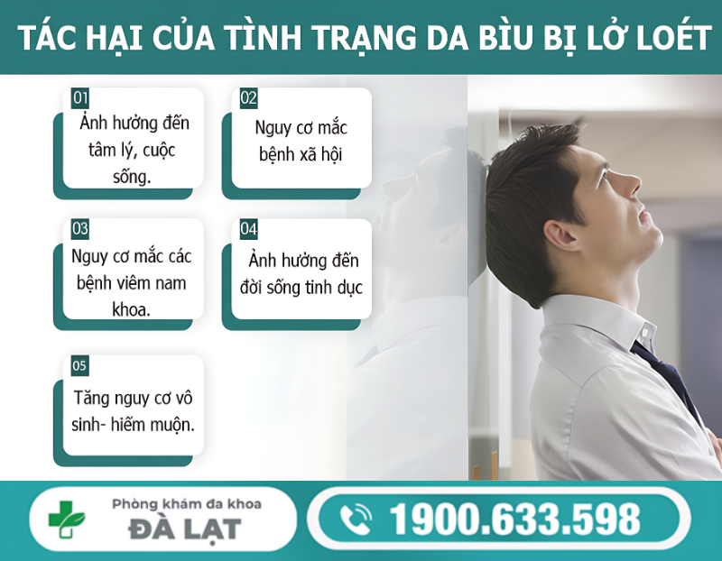 Hình ảnh minh họa